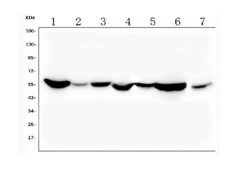 ALDH2 Mouse Monoclonal Antibody