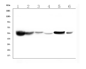ALDH2 Mouse Monoclonal Antibody