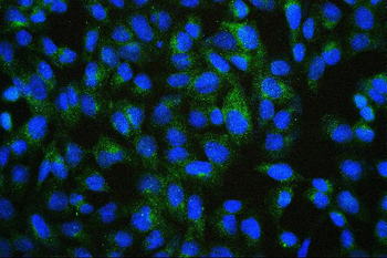 ALIX/PDCD6IP Antibody (monoclonal, 14D10)