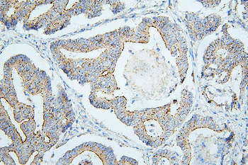 ALIX/PDCD6IP Antibody (monoclonal, 14D10)