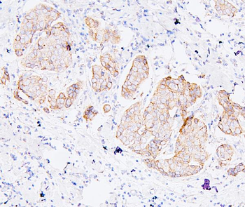 ALIX/PDCD6IP Antibody (monoclonal, 14D10)