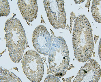 ALIX/PDCD6IP Antibody (monoclonal, 14D10)