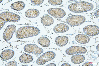 ALIX/PDCD6IP Antibody (monoclonal, 14D10)
