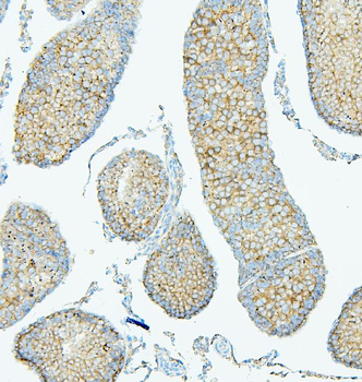 ALIX/PDCD6IP Antibody (monoclonal, 14D10)