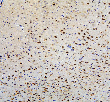 FACL4/ACSL4 Antibody