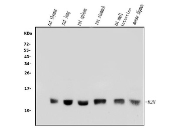 beta 2 Microglobulin/B2m Rabbit Polyclonal Antibody
