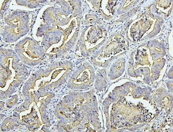 CEACAM5 Antibody