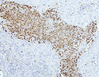 CEACAM5 Antibody