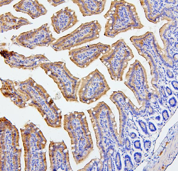 CEACAM5 Antibody