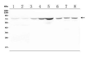 CPT2/CPT1 Rabbit Polyclonal Antibody