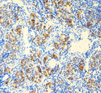 DDX1 Rabbit Polyclonal Antibody