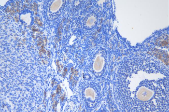 DDX1 Rabbit Polyclonal Antibody