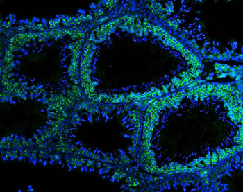 DDX4/MVH Antibody