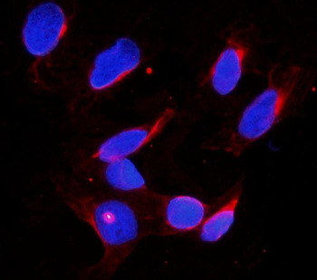DDX4/MVH Antibody