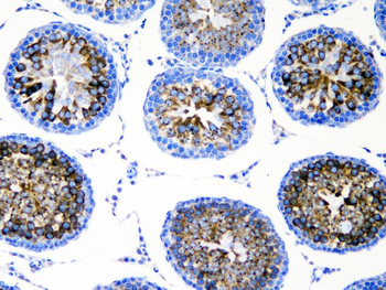 DDX4/MVH Antibody
