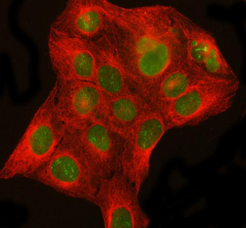 DHX15/prp43 Rabbit Polyclonal Antibody