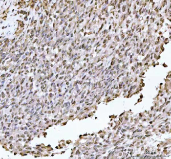 DHX15/prp43 Rabbit Polyclonal Antibody