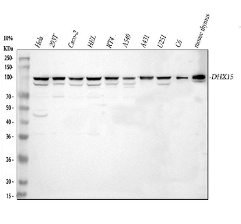 DHX15/prp43 Rabbit Polyclonal Antibody