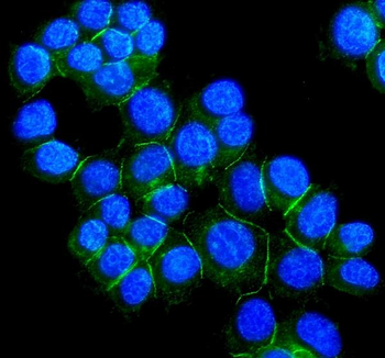 Desmoglein 2/DSG2 Antibody