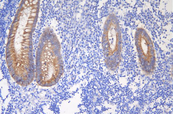 Desmoglein 2/DSG2 Antibody