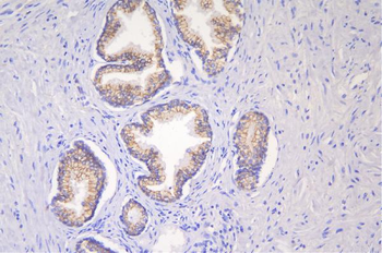 Desmoglein 2/DSG2 Antibody