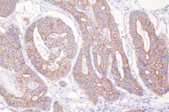 Desmoglein 2/DSG2 Antibody