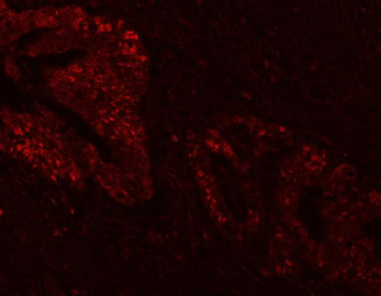 FEN1 Antibody