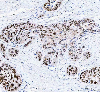 FEN1 Antibody