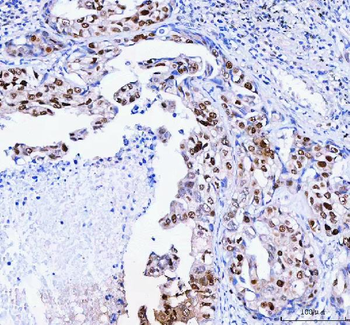 FEN1 Antibody