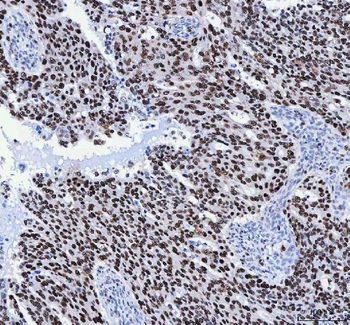 FEN1 Antibody