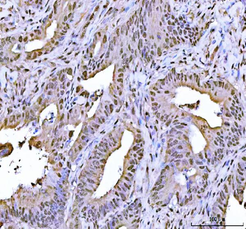 FEN1 Antibody