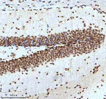 Histone H3 HIST1H3A/B/C/D/E/F/G/H/I/J Antibody