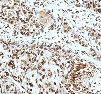 Histone H3 HIST1H3A/B/C/D/E/F/G/H/I/J Antibody