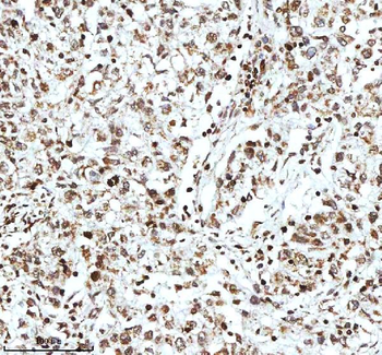 Histone H3 HIST1H3A/B/C/D/E/F/G/H/I/J Antibody