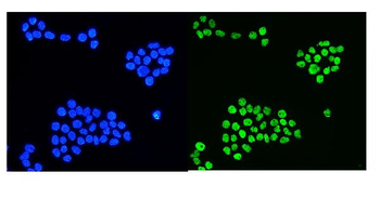 hnRNP D/AUF1/HNRNPD Antibody