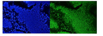 hnRNP D/AUF1/HNRNPD Antibody