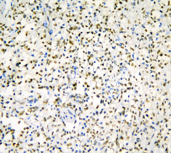 hnRNP D/AUF1/HNRNPD Antibody