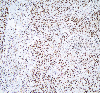 hnRNP D/AUF1/HNRNPD Antibody