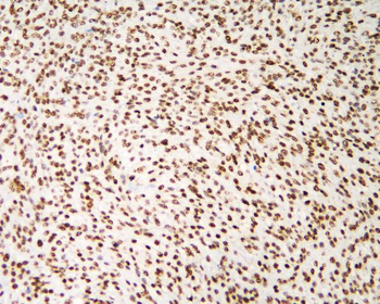 hnRNP D/AUF1/HNRNPD Antibody