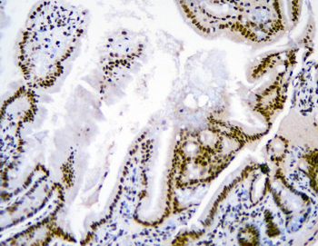 hnRNP D/AUF1/HNRNPD Antibody