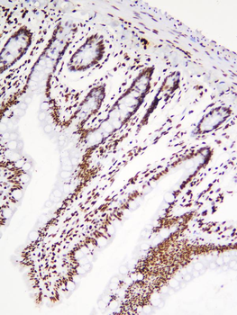 hnRNP D/AUF1/HNRNPD Antibody