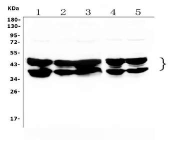 hnRNP D/AUF1/HNRNPD Antibody