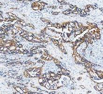 Cytokeratin 20/Krt20 Antibody