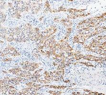 Cytokeratin 20/Krt20 Antibody