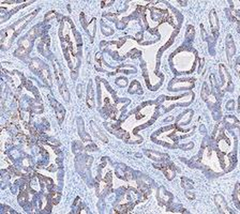 Cytokeratin 20/Krt20 Antibody
