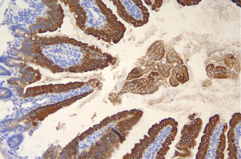 Cytokeratin 20/Krt20 Antibody