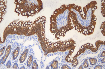 Cytokeratin 20/Krt20 Antibody