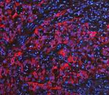 Cytokeratin 20/Krt20 Antibody