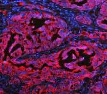 Cytokeratin 20/Krt20 Antibody