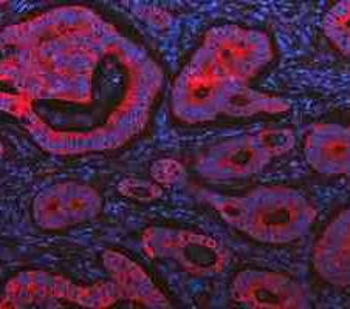 Cytokeratin 20/Krt20 Antibody